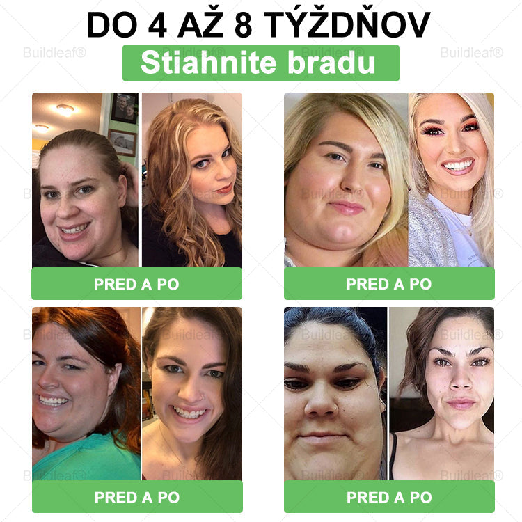 🌿BuildLeaf® GLP-1 8-v-1 Fit & Vital Perorálny Roztok (Len raz denne, viditeľné zmeny už za 7 dní) Pre obezitu, kardiovaskulárne ochorenia, cukrovku, spánkové apnoe, zdravie čriev, problémy s kĺbmi a ďalšie