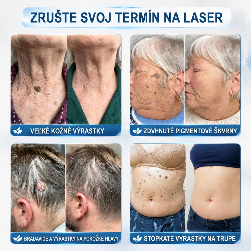 𝑶𝒇𝒊𝒄𝒊á𝒍𝒏𝒚 𝒐𝒃𝒄𝒉𝒐𝒅 ✅️ | 𝐇𝐈𝐒𝐊𝐈𝐍® 7-𝒅ň𝒐𝒗ý 𝒑𝒓í𝒑𝒓𝒂𝒗𝒐𝒌 𝒏𝒂 𝒐𝒅𝒔𝒕𝒓á𝒏𝒆𝒏𝒊𝒆 𝒌𝒐ž𝒏ý𝒄𝒉 𝒗ý𝒓𝒂𝒔𝒕𝒌𝒐𝒗 𝒂 𝒑𝒊𝒈𝒎𝒆𝒏𝒕𝒐𝒗ý𝒄𝒉 š𝒌𝒗ŕ𝒏👩‍⚕️ (𝒃𝒆𝒛 𝒃𝒐𝒍𝒆𝒔𝒕𝒊, 𝒃𝒆𝒛 𝒋𝒂𝒛𝒊𝒆𝒗, 𝒑𝒓𝒆𝒔𝒏ý 𝒓𝒐𝒍𝒍-𝒐𝒏 𝒂𝒑𝒍𝒊𝒌á𝒕𝒐𝒓) 🔥