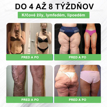 🌿BuildLeaf® GLP-1 8-v-1 Fit & Vital Perorálny Roztok (Len raz denne, viditeľné zmeny už za 7 dní) Pre obezitu, kardiovaskulárne ochorenia, cukrovku, spánkové apnoe, zdravie čriev, problémy s kĺbmi a ďalšie