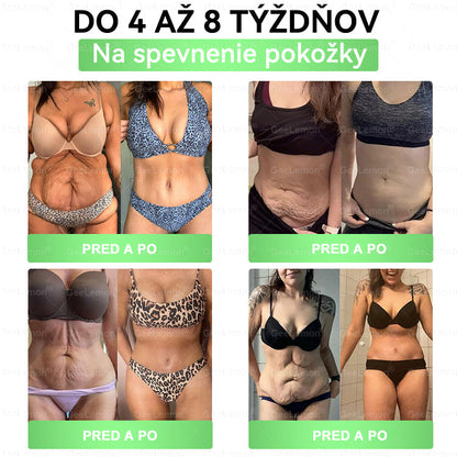 🔥Odporúčané UNB · 👩‍⚕️Oficiálny obchod Dr. Max | 🎁 𝐆𝐞𝑒𝐿𝑒𝐦𝐨𝐧® Glumasetide 8 v 1 Nano mikrotŕňový náplasť – Len raz denne ✅ Viditeľné zmeny za 7 dní na obezitu, ochabnutú pokožku a zdravie